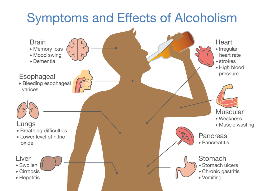  последици от пиенето на алкохол инфографики
