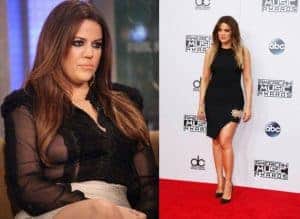  Frau vor und nach der Gewichtsabnahme