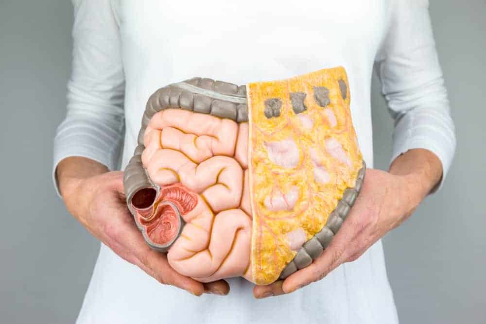  Modèle d'intestin humain