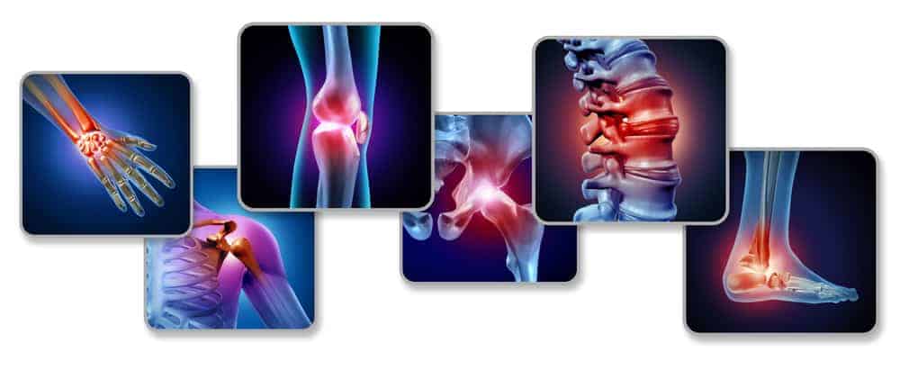 Beflexan - natuurlijke zalf voor blessures, artritis en gewrichtsontsteking 2 gewrichten