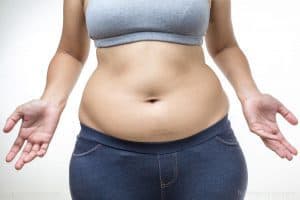  ženska s prekomerno telesno težo