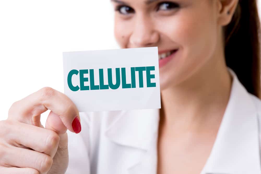  woman with cellulite plaque
